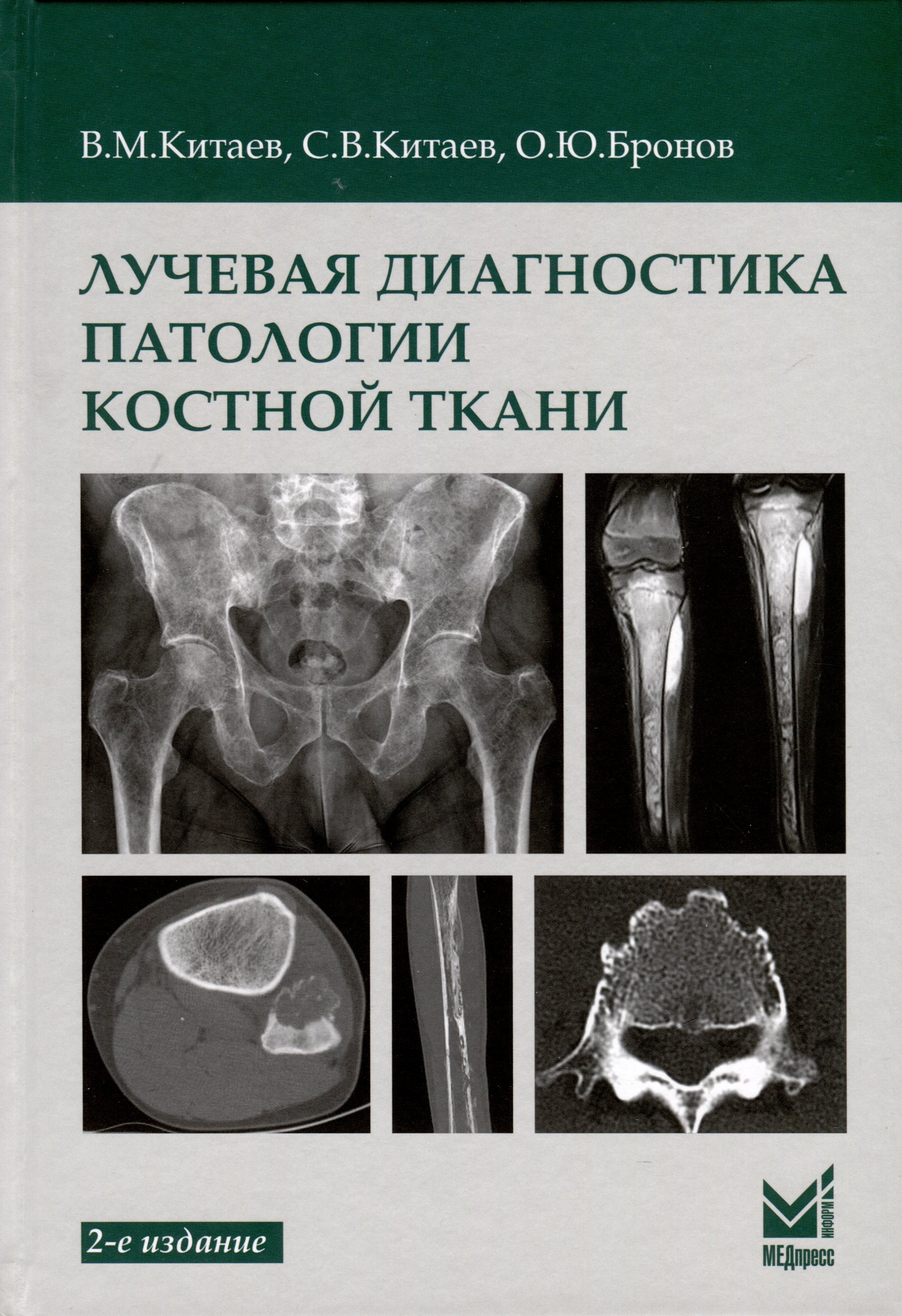 

Лучевая диагностика патологии костной ткани