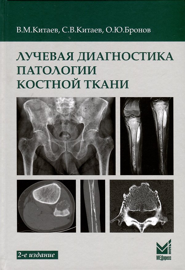 Книга Лучевая диагностика патологии костной ткани (Вячеслав Китаев, Сергей Китаев, Олег Бронов) — 1