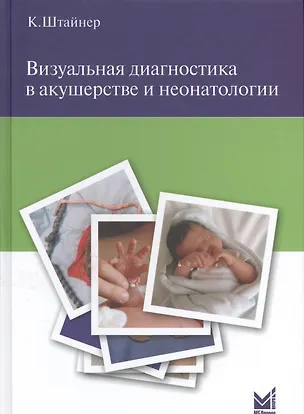 Книга Визуальная диагностика в акушерстве и неонатологии. (Керстин Штайнер)