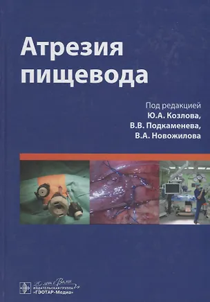 Книга Атрезия пищевода ()